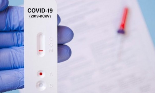 Bol on the island of Brač secures Covid Antigen Rapid Tests for its guests