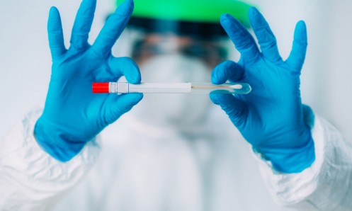 Procedure for PCR testing for COVID-19 in Supetar